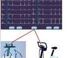 ЭКГ Электрокардиограф 12-канальный ECG-1550, Nihon Kohden - фото 4