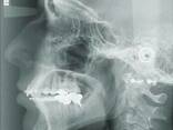 Рентген аппарат дентальный панорамный - photo 4