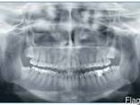 Рентген аппарат дентальный панорамный - photo 5